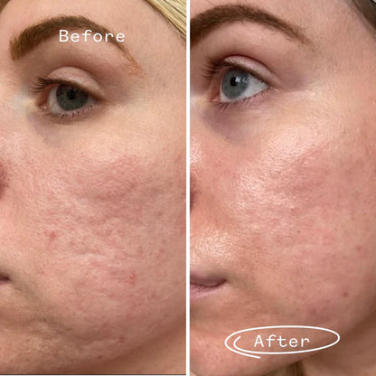 Hyaluronic Acid Powder